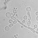 Image of Candida albicans