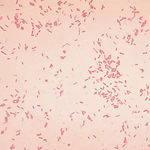 Image of Aeromonas hydrophila