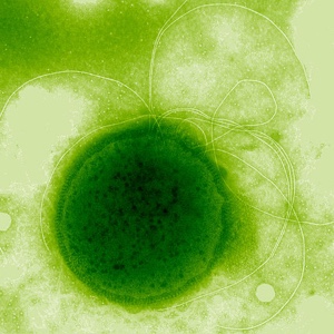 Image of Thermococcus gammatolerans