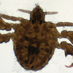 Image of Pthirus pubis