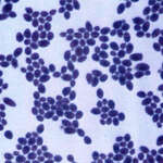 Image of Saccharomyces cerevisiae