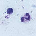 Image of Plasmodium falciparum
