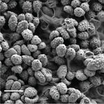 Image of Spongiforma squarepantsii