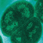 Image of Deinococcus radiodurans