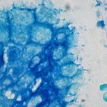 Image of Helicobacter pylori SJM180