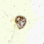 Image of Lenticulina rotulata