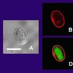 Image of Giardia intestinalis