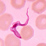 Image of Trypanosoma brucei