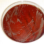 Image of Mycobacteroides abscessus