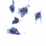 Image of Naegleria fowleri